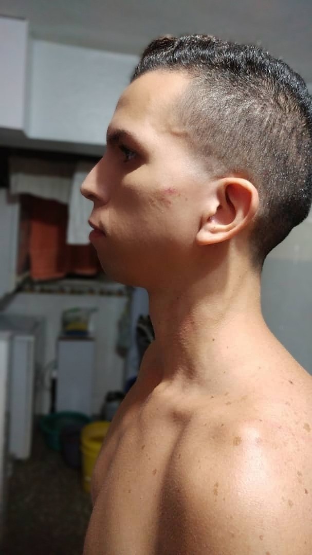 Josmel García (@josmelgarcia) on Twitter photo Anoche mi cuñado Ángel Mendoza intento asesinarme con un cuchillo tras golpearme con un tubo por la espalda. Me persiguió con el arma mientras gritaba "te voy a matar". Pude escapar pero lo hago responsable de lo que pueda ocurrirme. Agradezco RT para exponer a ese delincuente. Anoche mi cuñado Ángel Mendoza intento asesinarme con un cuchillo tras golpearme con un tubo por la espalda. Me persiguió con el arma mientras gritaba "te voy a matar". Pude escapar pero lo hago responsable de lo que pueda ocurrirme. Agradezco RT para exponer a ese delincuente.