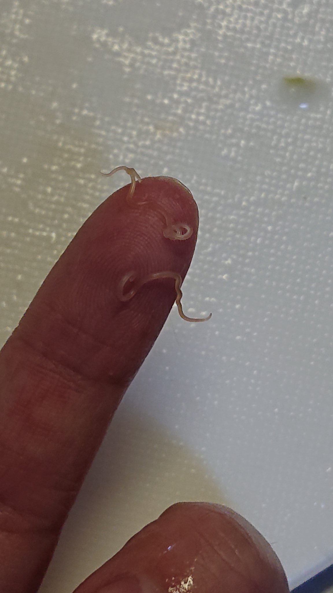 旭川医大寄生虫学講座 鍋がおいしい季節ですね 北海道では海のカジカが安く売っていて おいしいんですよ 肝の表面に小さな丸を見つけたら それはアニサキス幼虫です ぐるぐるをほぐしてあげると 虫体が出てくるよ 鍋にしちゃうから いても気にしま