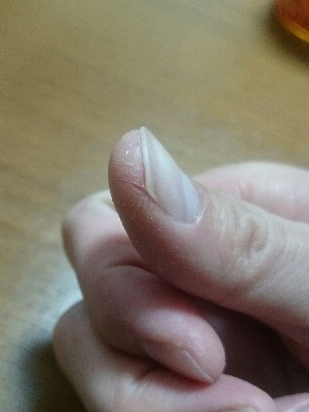 文月タカヒロ Twitter પર 俺は冬になると乾燥肌で指先が裂ける側の人間だ お前たちはこちら側に来てはいけない