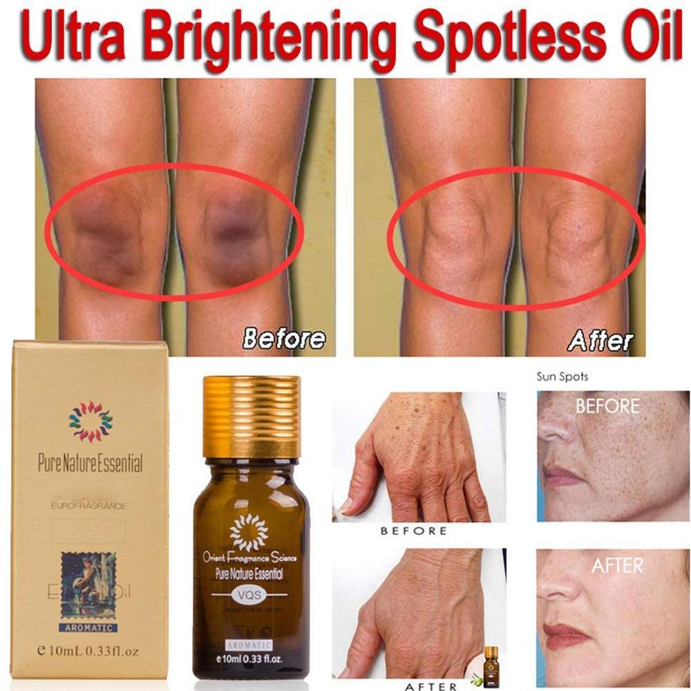 shopjluv876's tweet photo. 10ML Pure Natural Essenti is now available in our shop for only $17.99. Buy it now  https://t.co/ojoOQfXsrJ https://t.co/5jJlFHxH5f