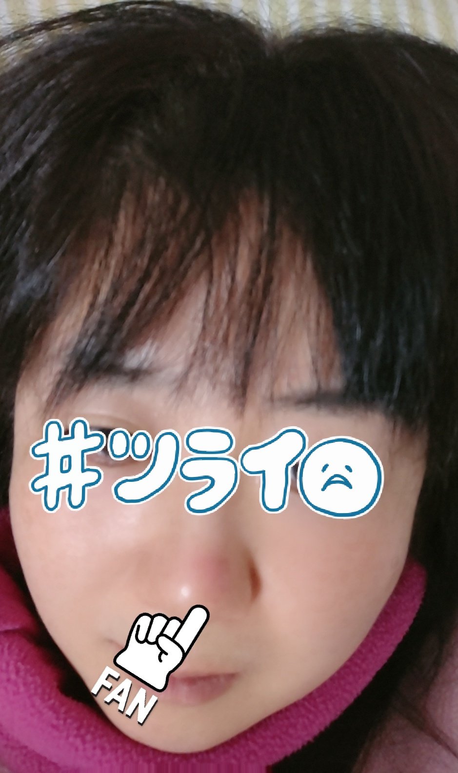 ট ইট র エマ 鼻の頭が赤くなって少し腫れている 家族からは 一杯飲んでほろ酔いのコントに出てくるおじさんのようだ と言われた 酔っていない 鼻の頭 赤い おできだよ ট ইট র エマ 鼻の頭が赤くなって少し腫れている 家族からは 一杯飲んでほろ酔いのコントに出てくるおじさんのようだ と言われた 酔っていない 鼻の頭 赤い おできだよ