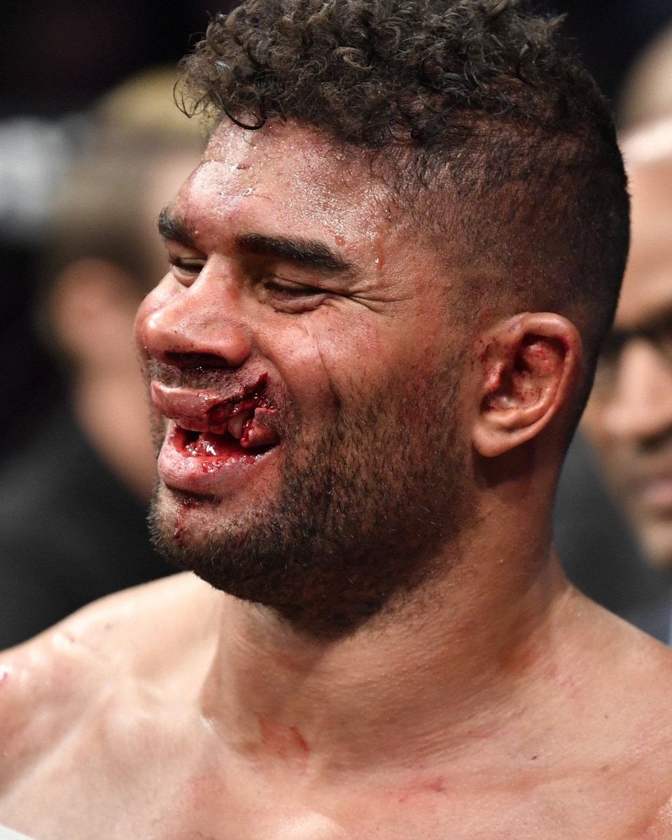 MaximoApex's tweet photo. Wow #ufc #AlistairOvereem https://t.co/gZyszqNTyl