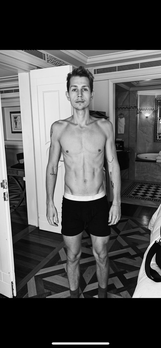 TheVampsJames's tweet photo. One year on from #ImACeleb ... only just recovered 😂 64kg - 72kg. https://t.co/pGkj3iZIfy
