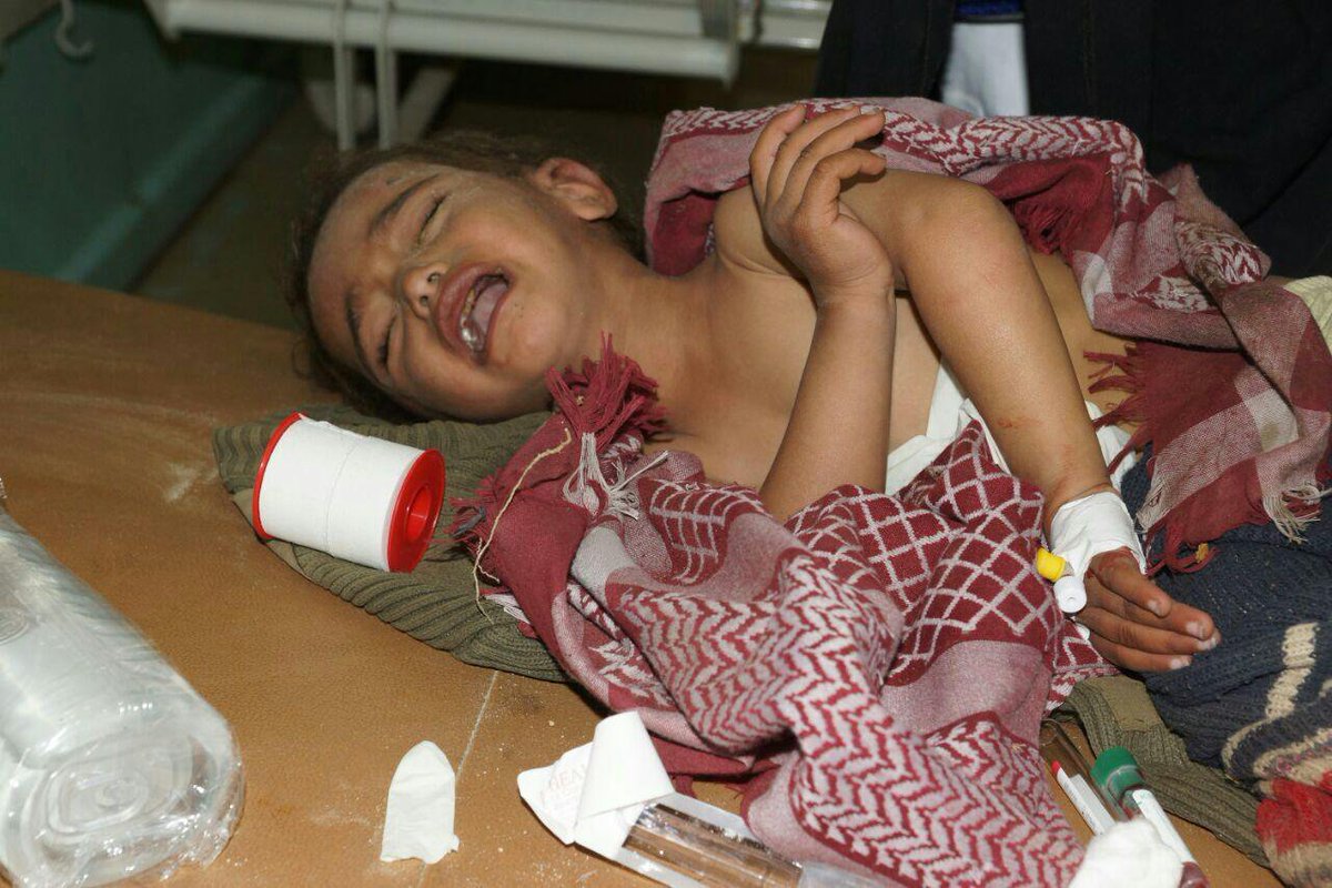 alamrani209's tweet photo. What human rights celebrate the world today while dozens of # Yemeni people are killed by siege of the coalition of aggression every day for five years under a global silence? #YemenisAreHumans #HumanRightsDay https://t.co/fYD7HYrj9p