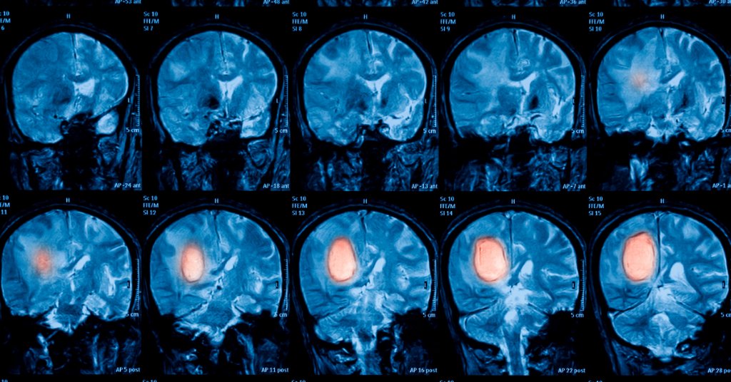 blood work detect covid 19