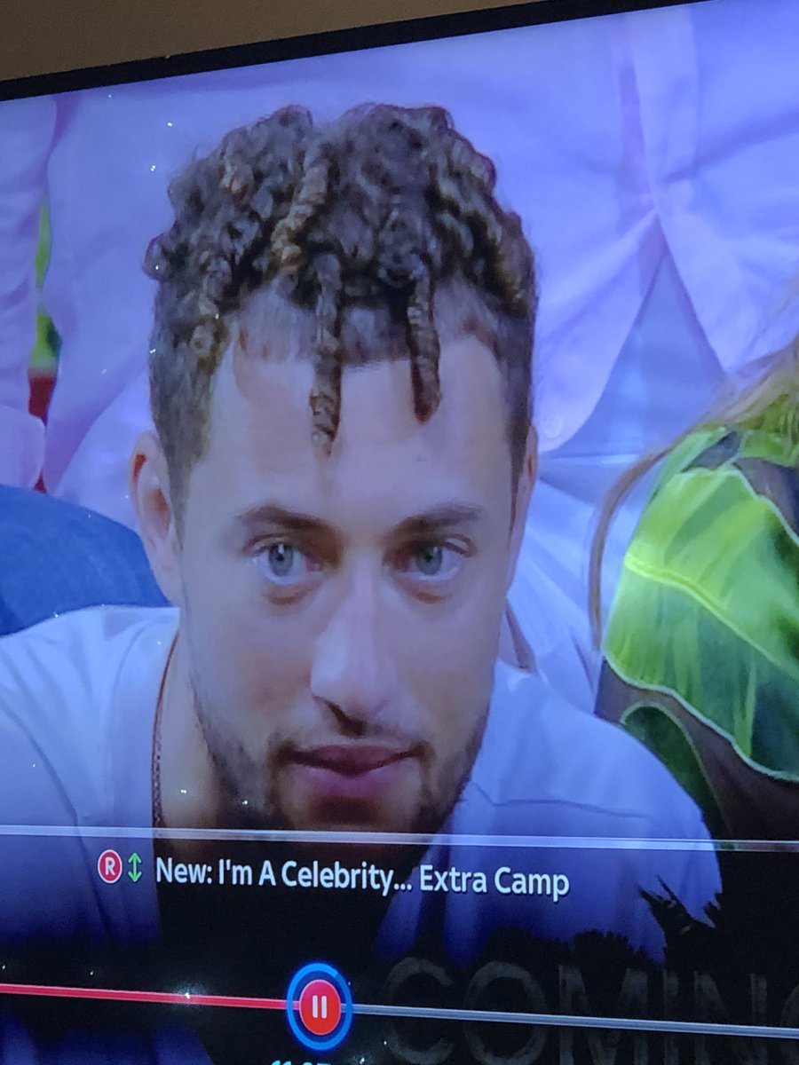AntHil86's tweet photo. I can’t say much about hair myself but WTF has Myles done!? 😆😂 #iacgmooh #ImACeleb #ShitLocks https://t.co/E132ZYY87n