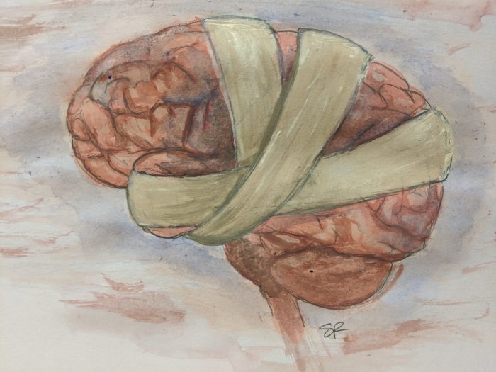 CNeurochem's tweet photo. Can you match these #artstracts with their topics?
#MetabolicSyndrome #Concussion #Autism #Addiction
https://t.co/FUWy0uiBcb #cordmn https://t.co/wGwzFfeYcM