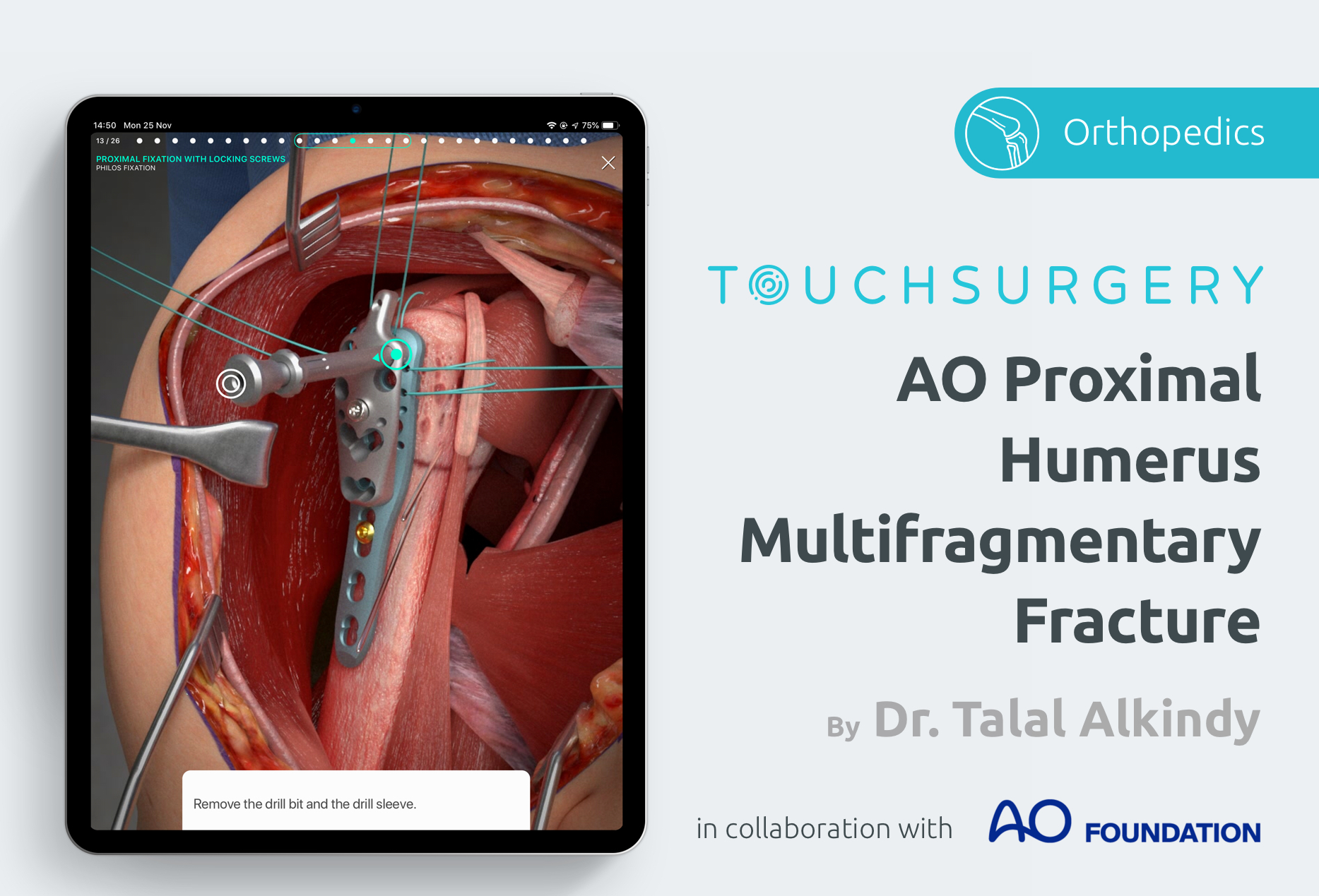Touch Surgery By Digital Surgery Auf Twitter We Re Excited To Announce The Release Of Our Latest Orthopaedics And Trauma Procedure Ao Proximal Humerus Multifragmentary Fracture Developed In Collaboration With Aofoundation Learn More