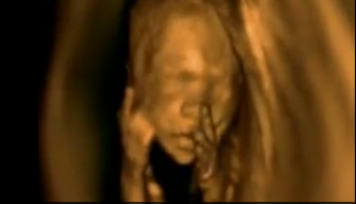LiveAction's tweet photo. @PPFA Harm to your bottom line is the only negative effect of showing women their babies on an ultrasound. 

Women deserve to know the humanity of their children you're targeting for destruction. https://t.co/PbA6V7o0Yv