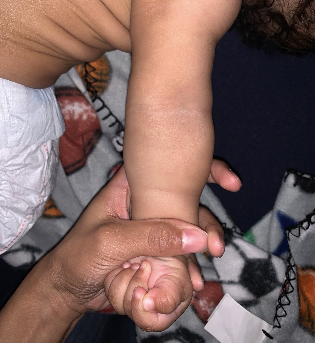 Here’s how I “got rid” of my son’s eczema: