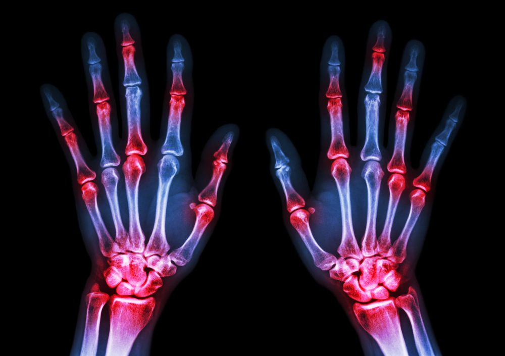 MDedge Rheumatology tweet media