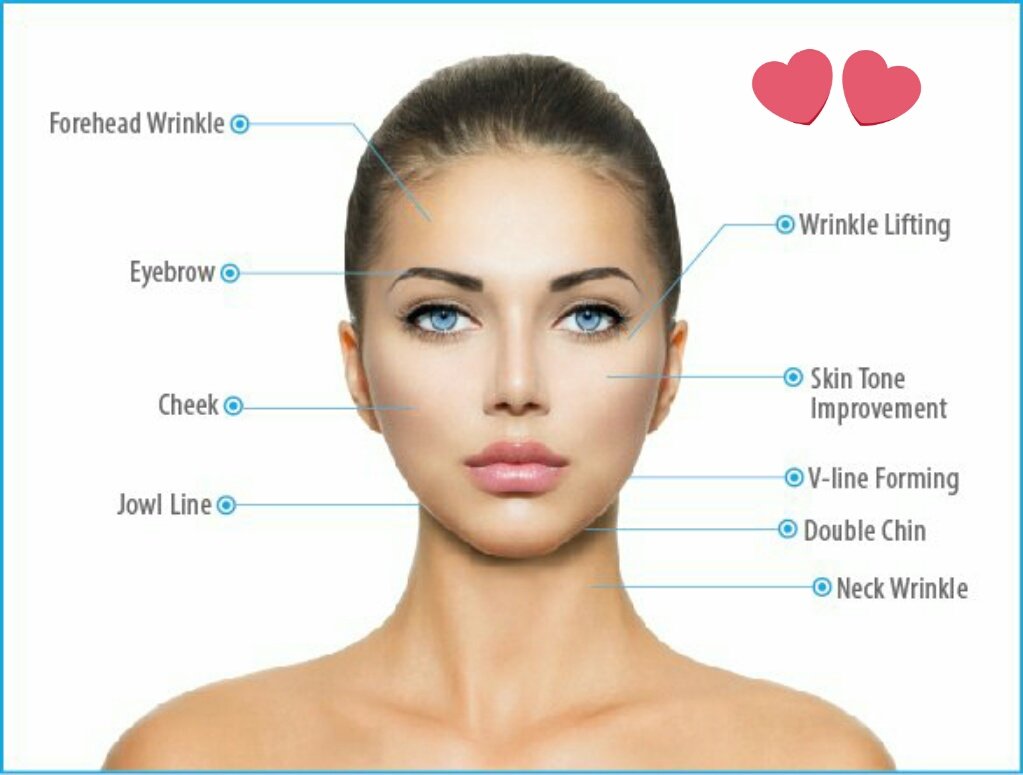 LasersNk's tweet photo. 🎄#dentalhour Nklasers 3D Hifu non-invasive, non-surgical, no injections 💉 for removal of wrinkles &amp; fine lines, necklift, eyelift, tightens jawline at St.Vincent Smile Dental Practice in #Finneston  #Glasgow #onetreatment #facelift #bodycontouring #AntiAging #tistheseason 🎄 https://t.co/sIgcedoPOk