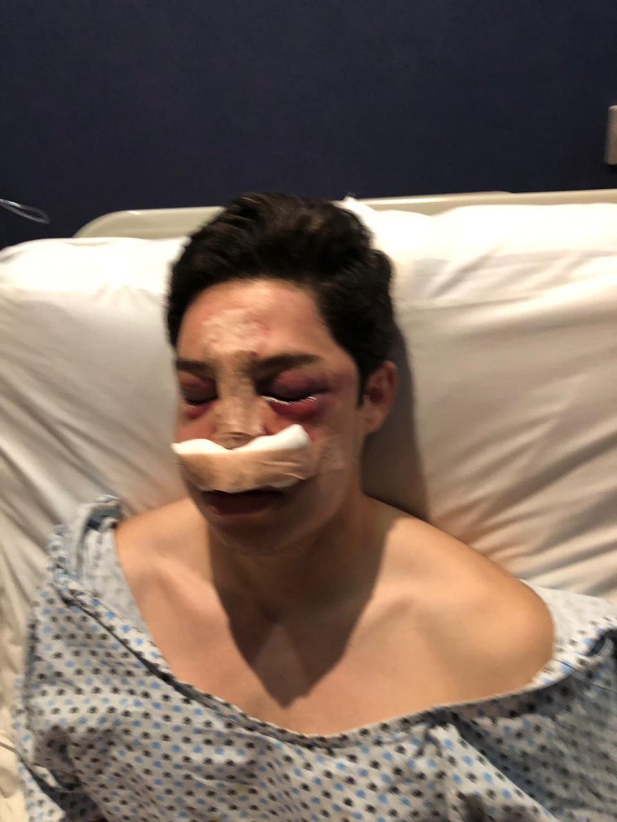 cosapublica's tweet photo. Así quedó el joven golpeado por los 6 ciudadanos, entre ellos 3 familiares del propietario del Hotel Tabasco Inn. ¡ Órale #MiFiscal Jaime Lastra ..¿ Rumbo al informe del 12 ? @FGETabasco https://t.co/ZDXFvEItJC