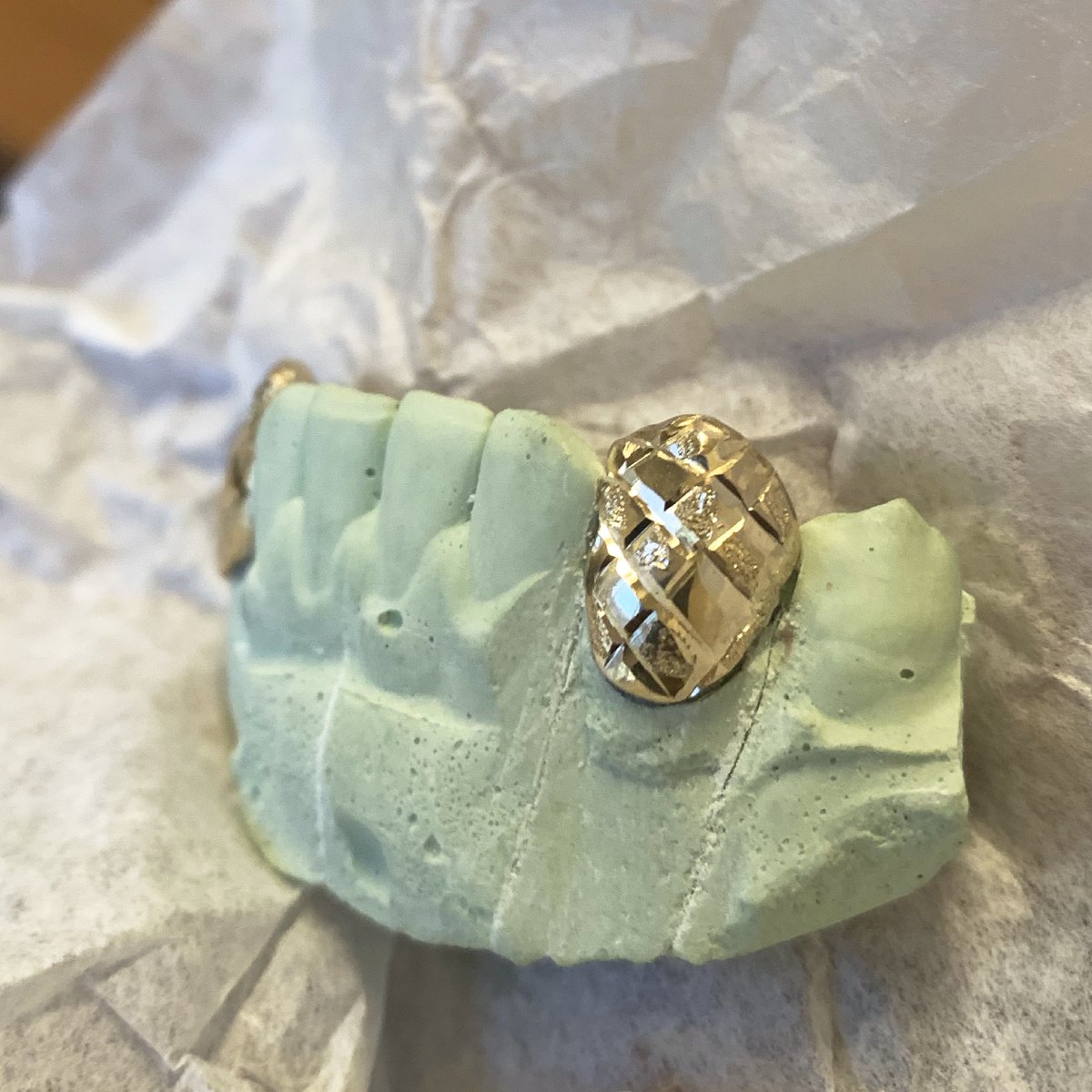 206goldgrills's tweet photo. Checkerboard #GoldFangs are definitely the latest greatest.. #PopularDemand Starting @ $230 โ๐พ๐๐พ https://t.co/YEcszNHBtM