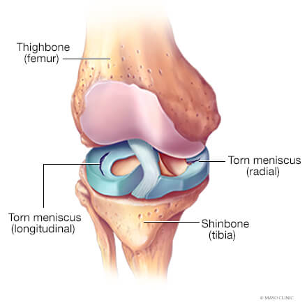 Mayo Clinic Orthopedic Surgery tweet media