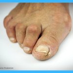 Photo by Perth Foot Ankle (@PerthFootAnkle)