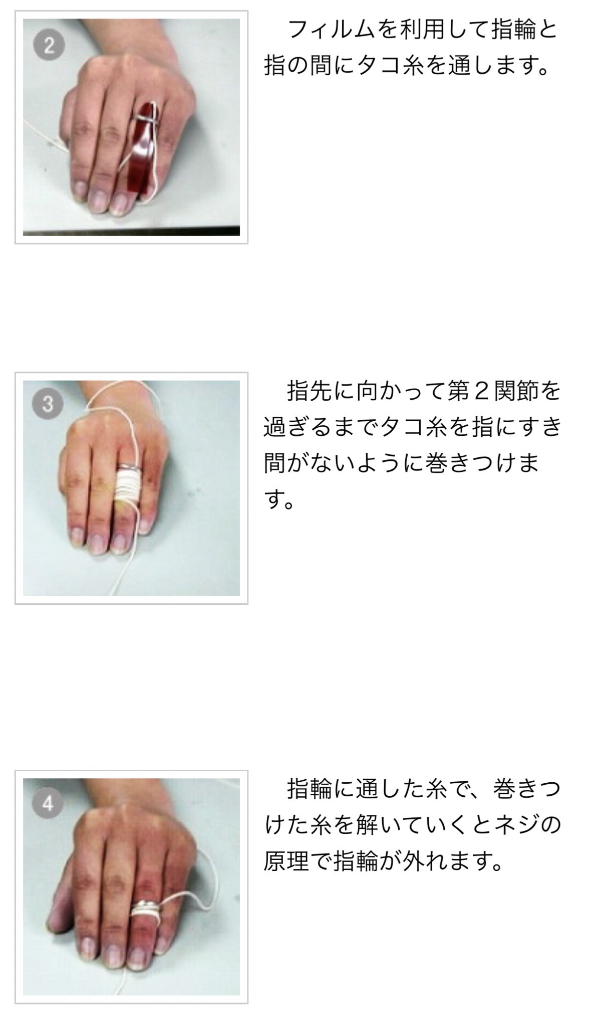 おると 整形外科医 取れない場合はリングカッターというものを使って指輪を切る必要が出てきます 結婚指輪など大切な指輪を切らなければいけない場合などは こちらも心が痛みます 必ずすぐに外すようにしましょう Twitter