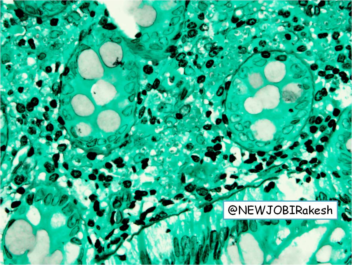 NewjobiRakesh's tweet image. 