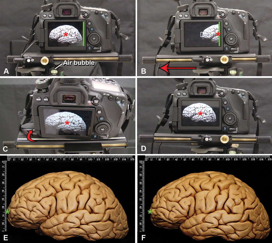NASBSorg's tweet photo. #JNLSB_OnlineFirst
Foundations of Advanced Neuroanatomy: Technical Guidelines for Specimen Preparation, Dissection, and 3D-Photodocumentation in a Surgical Anatomy Laboratory
#neuroanatomy #education #training https://t.co/syWKEfrsJs https://t.co/FPX3px8goF