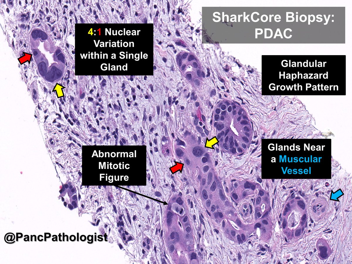 PancPathologist tweet picture