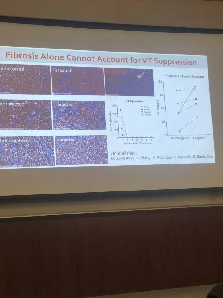 Andrew Voigt (@andrewvoigtmd) on Twitter photo Thank you to <a href="/DoctorPhillEP/">Phillip Cuculich, MD</a> and <a href="/SBRT_CR/">Cliff Robinson</a> for sharing your groundbreaking collaborative work on noninvasive VT ablation with us at <a href="/PittCardiology/">Pitt Cardiology</a>. <a href="/KrishKancharla/">Krishna Kancharla</a> Thank you to <a href="/DoctorPhillEP/">Phillip Cuculich, MD</a> and <a href="/SBRT_CR/">Cliff Robinson</a> for sharing your groundbreaking collaborative work on noninvasive VT ablation with us at <a href="/PittCardiology/">Pitt Cardiology</a>. <a href="/KrishKancharla/">Krishna Kancharla</a>