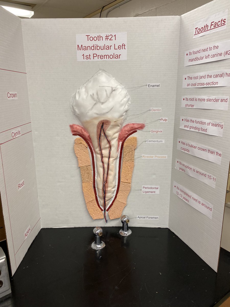 MrsNonni_4's tweet photo. More teeth! Love the creativity @ParmaSchools @OHEducation @CharlesSmialek https://t.co/Shu31JDZVy
