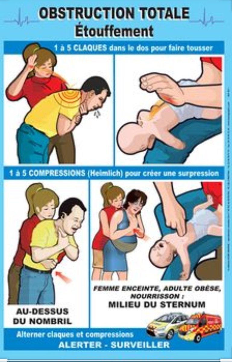 tohangfire's tweet photo. L'histoire de Jessica montre combien il est important de connaître les gestes de premiers secours. Passez votre PSC1, ca dure quelques heures, c'est organisé par des casernes, par la Croix-Rouge, dans les facs, les lycées... Ca devrait être obligatoire à l'école. https://t.co/fQmfVgK9Ba