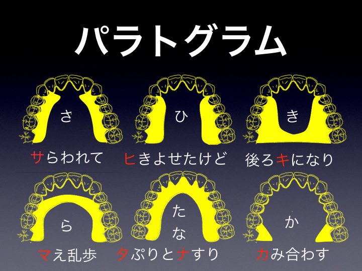 تويتر 日本大学松戸 有床義歯補綴学 على تويتر パラトグラム 語呂 皿 さ 割れて 引 ひ き寄せたけど まだ足りず 後ろ気 き になり 前乱 ら 歩 た た ぷりとな な すり か か み合わす 発音 構音 T Co Oe1lt0gaqv تويتر 日本大学松戸 有床義歯補綴学 على تويتر パラトグラム 語呂 皿 さ 割れて 引 ひ き寄せたけど まだ足りず 後ろ気 き になり 前乱 ら 歩 た た ぷりとな な すり か か み合わす 発音 構音 T Co Oe1lt0gaqv