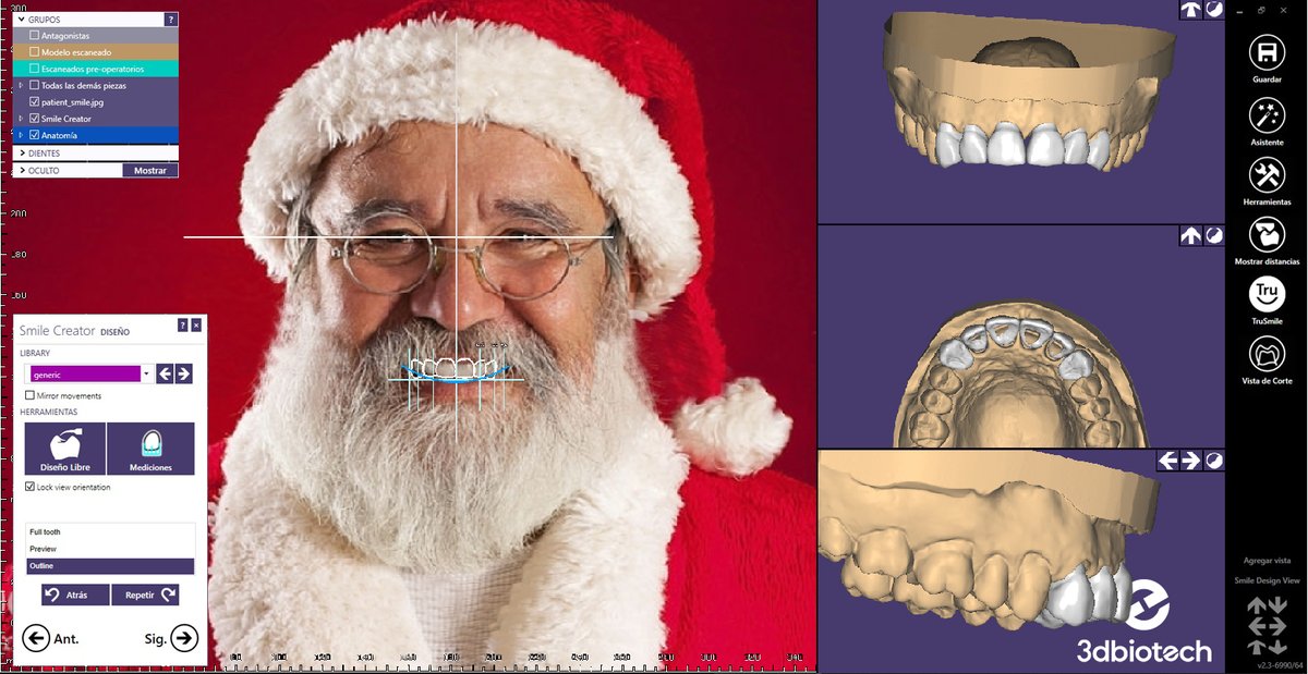 3DBiotech's tweet photo. En estas fechas hasta el protagonista necesita unos retoques en su sonrisa!...con el uso del DSD y el TruSmile.
Desde 3DBiotech os queremos desear unas felices fiestas!
#3DBiotech #FelizNavidad #FelicesFiestas #Navidad2019 #Exocad #MerryChristmas #JoyeuxNoël #FroheWeihnachten https://t.co/73D4eXpkeV