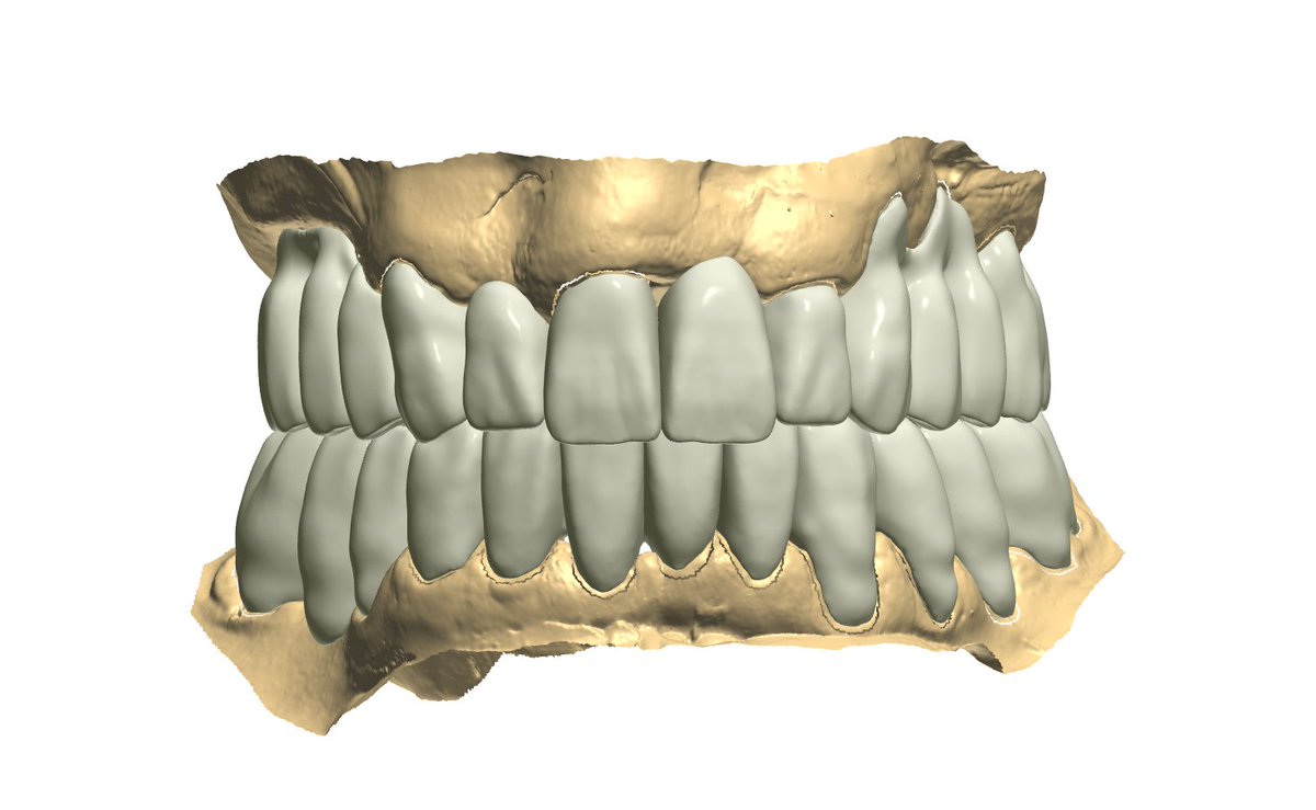Ian dental design