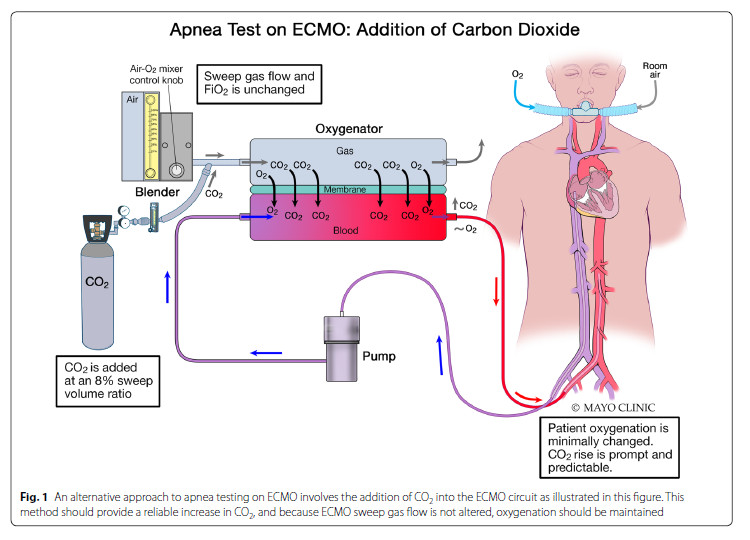 Dr. Brian Beam published "The Physiology of the Apnea Test for Brain Death Determination in ECMO: Arguments for Blending Carbon Dioxide" in <a href="/NeurocritCareJ/">Neurocritical Care</a> 
#MayoAnesResearch by <a href="/wbbeam85/">Brian Beam</a> et al.
bit.ly/2Oo3z3B