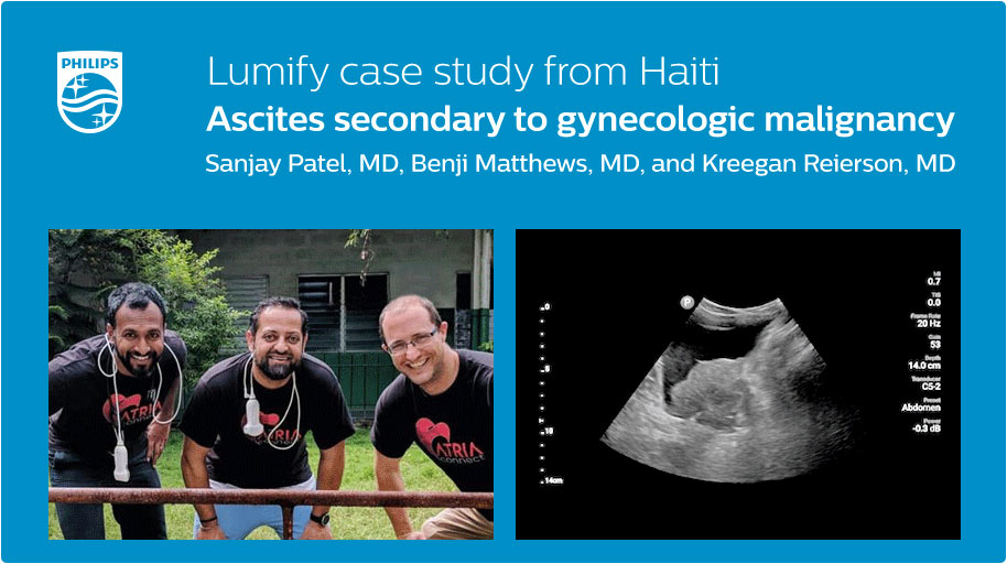 Philips POCUS tweet media