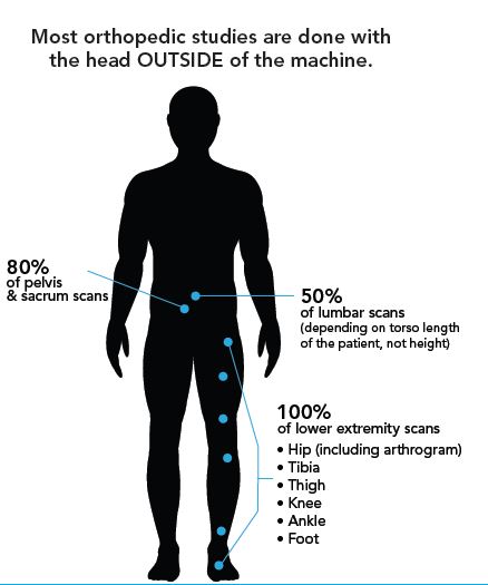 shields_health's tweet photo. Did you know 80% of scans can be done with your head outside of the MRI machine? Find a Shields OPEN MRI near you! https://t.co/BaplVob69B https://t.co/i75BkpOPJp