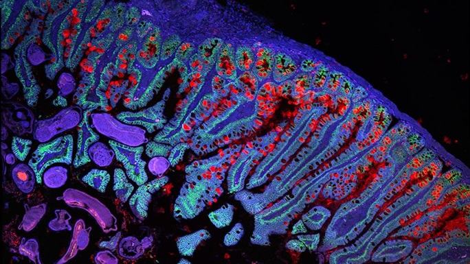 Two University of Chicago research teams have received funding from the Helmsley Charitable Trust to contribute to building a Gut Cell Atlas. ms.spr.ly/6016TV2tK