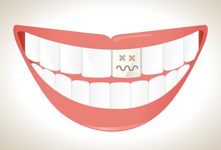 YDHRmagazine's tweet photo. If your tooth has been damaged from decay or an accident, there’s a chance that your tooth will turn a darker color. With the right care, your #smile can stay bright and healthy for years to come! https://t.co/xMBAu9sPYa

#dentistry #dentist #health https://t.co/T5r2QliAhZ