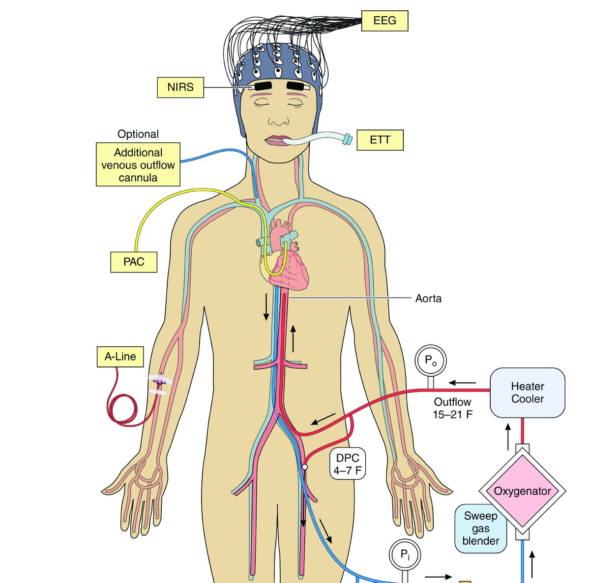 Circulation (@circaha) on Twitter photo #InDepth: VA-#ECMO for cardiogenic shock: An introduction for the busy clinician ow.ly/DmaS50xwBOY @PeterEckmanMD <a href="/EBohula/">Erin Bohula</a> <a href="/seanvandiepen/">Sean van Diepen</a> #AHAJournals #InDepth: VA-#ECMO for cardiogenic shock: An introduction for the busy clinician ow.ly/DmaS50xwBOY @PeterEckmanMD <a href="/EBohula/">Erin Bohula</a> <a href="/seanvandiepen/">Sean van Diepen</a> #AHAJournals