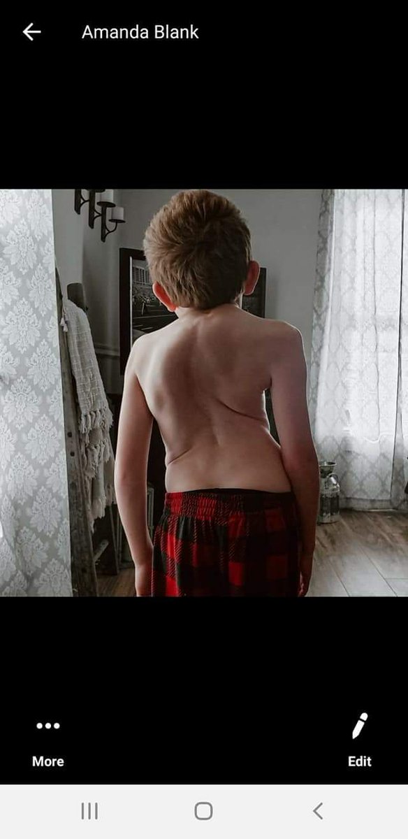 ssageser's tweet photo. @Carlos_Dunlap @BengalsCaptain @LanceMcAlister @Bengals @andydalton14 @GenoSacks @ajgreen_18 @DreKirkSWAG @b_price53 This young man's name is River. He is a huge Bengals fan and has a Christmas wish of seeing his team play a game.  Needless to say, River has been through a great https://t.co/4GfgqXcn9C