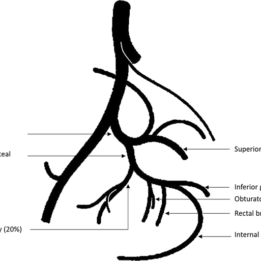 cirsesociety's tweet photo. Enjoy free access to CIRSE's latest SOP document on #ProstateArteryEmbolisation as an effective method for treating symptoms related to benign prostatic hyperplasia! https://t.co/ONoTjxsOI5 #CIRSEsociety #embolotherapy https://t.co/LTNV8gnBWh