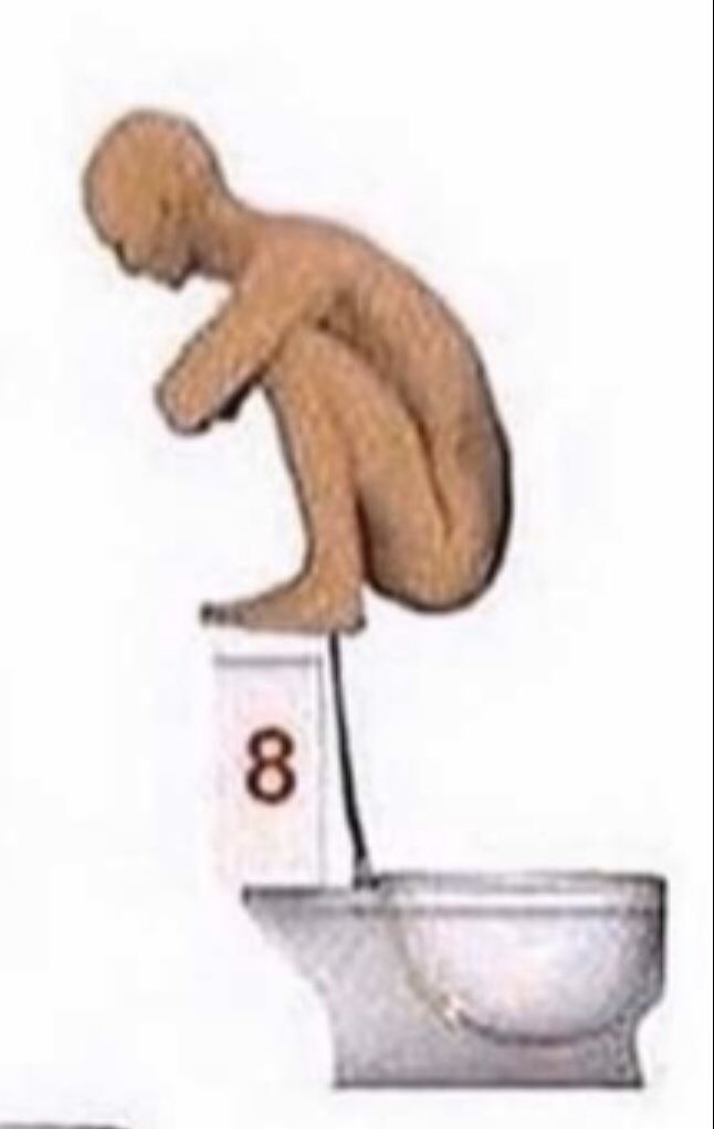 lumpy_head's tweet photo. Yoo who else shit like this https://t.co/pT7YDnFIUM