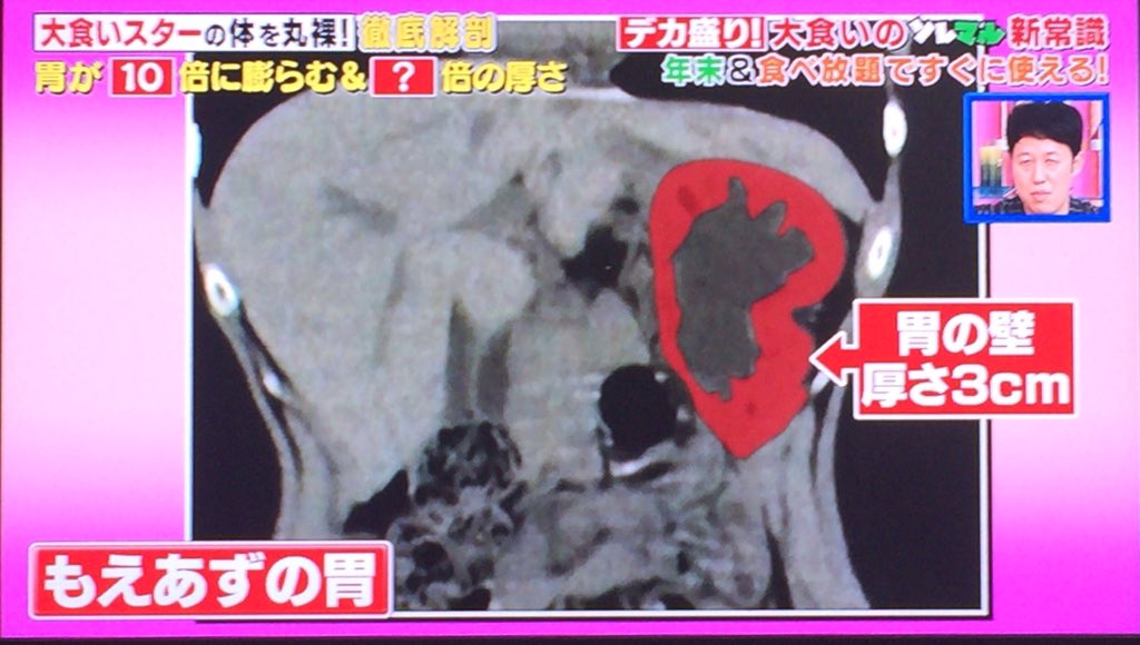 あけぼし 大食いのもえあずさんの大食い後の胃の大きさエグすぎるでしょ やっぱり適合者じゃないと大食いって出来ないんやなって