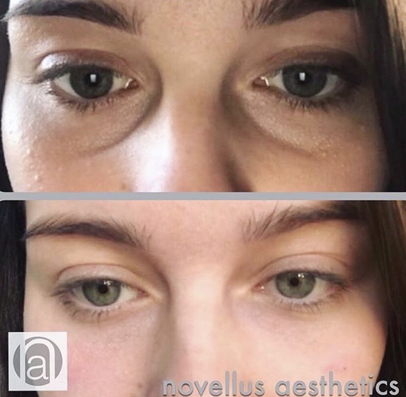 Get Novellus Aesthetics On Twitter Did You Know That At Novellus For iPhone Wallpaper Novellus Aesthetics On Twitter Did You Know That At Novellus Free HD