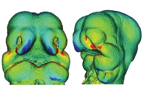 DevelopmentalDy's tweet photo. Cleft lip and palate are among the most common human birth defects, but their underlying etiology is poorly understood. Learn how the intersection of morphology, gene expression, and DNA methylation contributes to the pathogenesis of orofacial clefting.
 https://t.co/yCNr63ycRw https://t.co/I6CZkMSQig