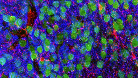 BrainFitNow's tweet image. Caught My Eye: @Cornell researchers describe gut health influence on brain health ow.ly/5bS450xdbnC #Alzheimers #dementia #dementiarisk #brainhealth