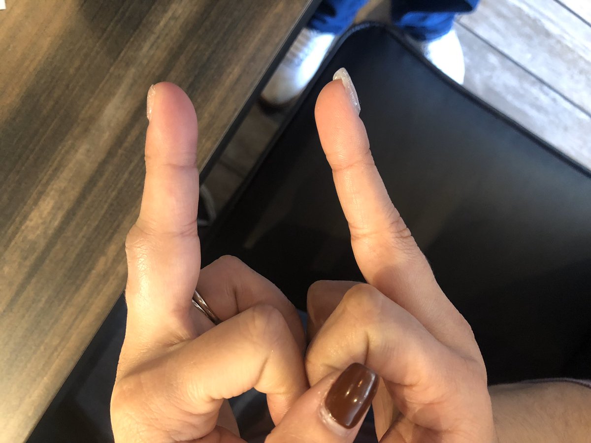 xstarbrightx's tweet photo. Oh ya know just caught my finger in an industrial dough roller at work. It’s fine. I’m fine. #bakerylife https://t.co/PSlG41Wvvr