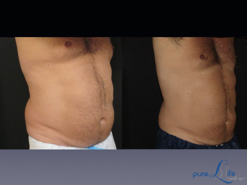 Pure Life Medi Spa tweet media