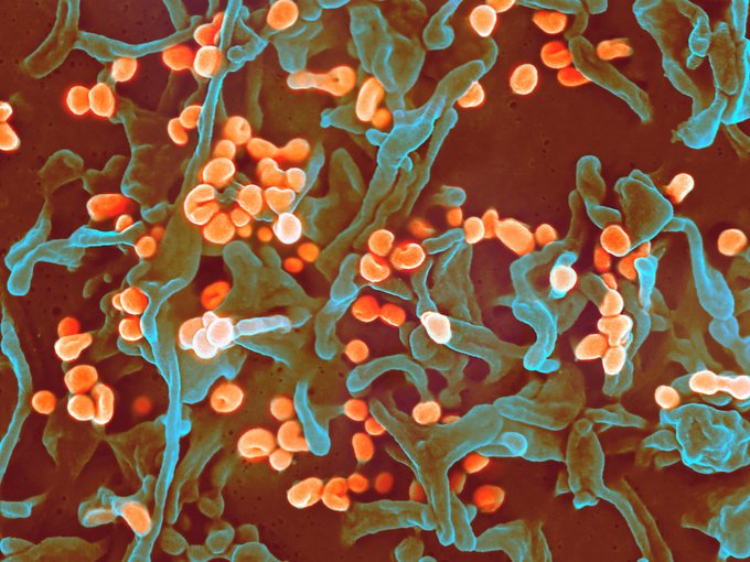 Structural immunologist and EG speaker alum, Dr. Erica Ollmann Saphire, and her team recently identified<a href="/tag/egconf"class="tags"><span>#egconf</span></a>