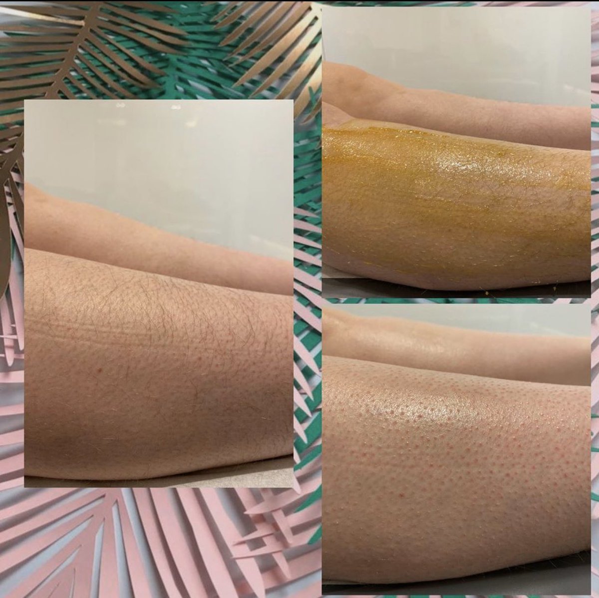 Designerwaxing's tweet photo. Half Leg Wax... Before, during and after using our @OutbackOrganics gold strip wax 🙌🏻 #halfleg #legwaxing #waxing #waxingsalon #outbackorganics #designerwaxing #glasgow #edinburgh https://t.co/LDL9dArWkJ