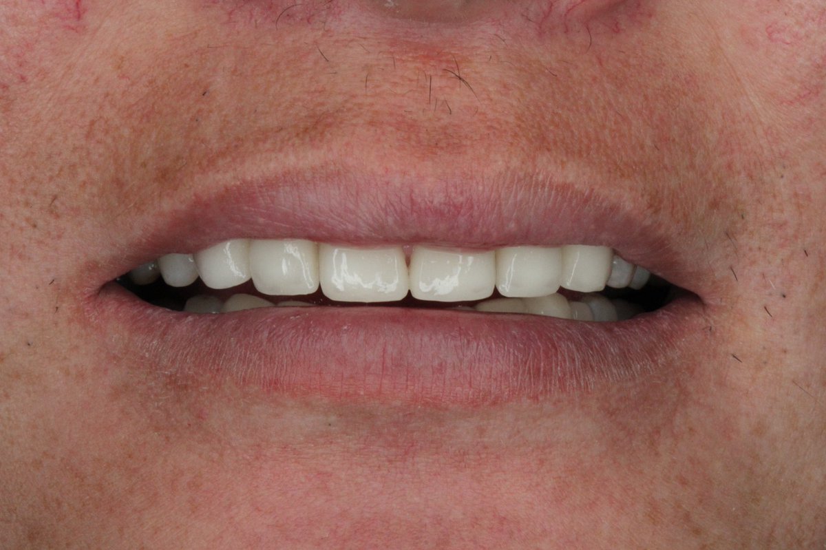 Ойрд шинэ зураг хийсэнгүй.Манай эмнэлэг шангри-ла 2давхарт 77070722 дугаарт цаг аваарай.