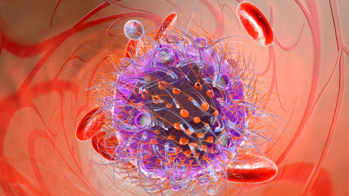 DrepaConseils's tweet photo. https://t.co/wFYyybN69y
La prévention des infections chez le drépanocytaire reste un point majeur pour son état de santé. En effet, du fait de la drépanocytose, il fera face à plusieurs types d’infections durant sa vie, entre autres,  urinaires, osseuses, pulmonaires etc… https://t.co/D1FbQzDqXK