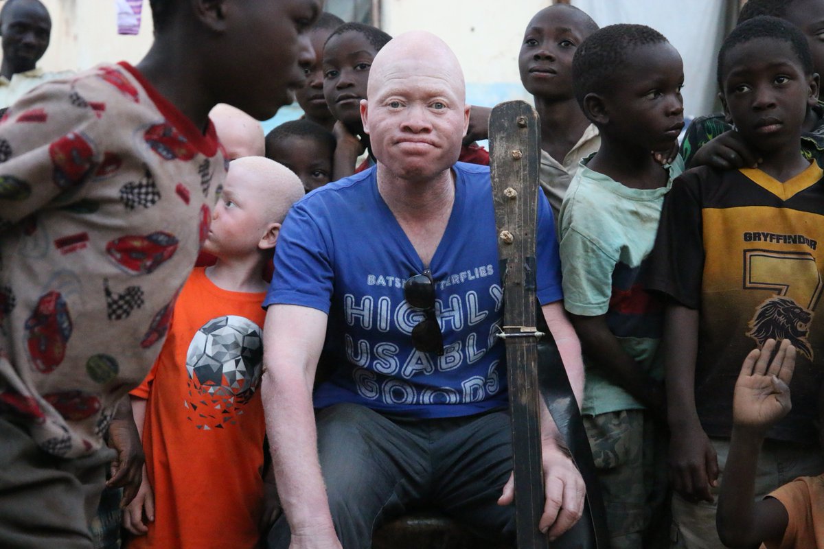 hallaboutafrica's tweet photo. Congrats Malawi's Lazarus Chigwandali: a new US-produced documentary movie is helping the musician draw global attention to the plight of people like himself who live with albinism. In May he personally won an award at New York's Tribeca Film Festival. https://t.co/PF5b498gdt